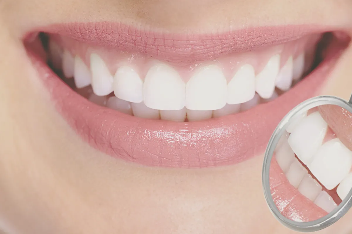 Sourire éclatant et miroir dentaire